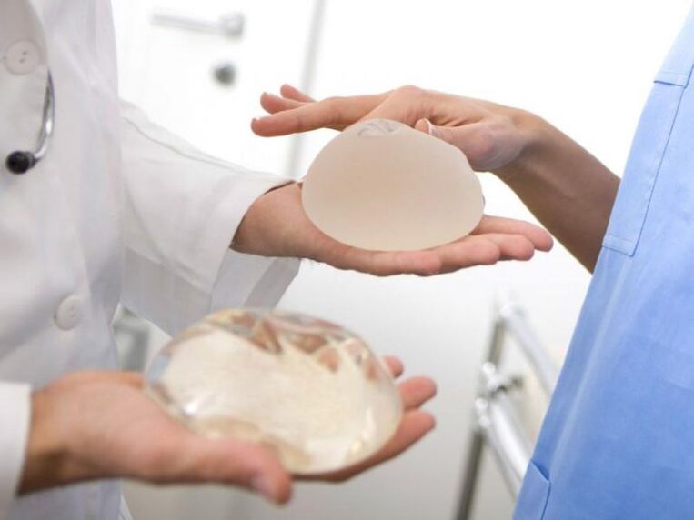 Implantes