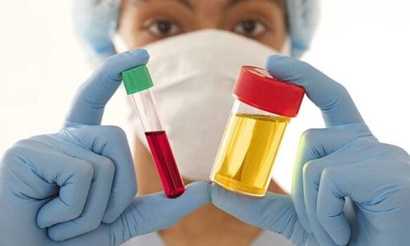 Análisis de sangre y orina antes de la cirugía de aumento de senos.